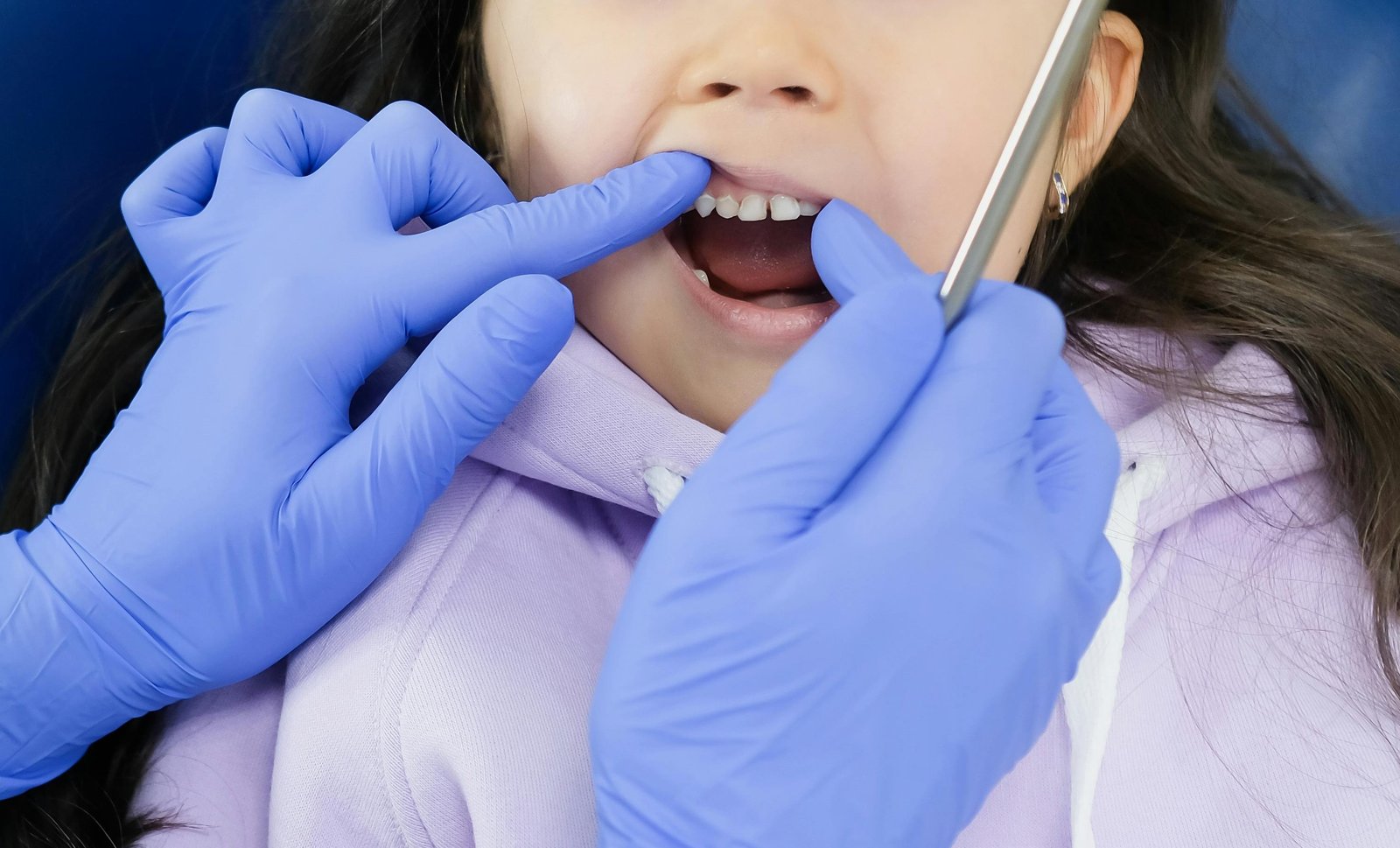 Soins dentaires enfant